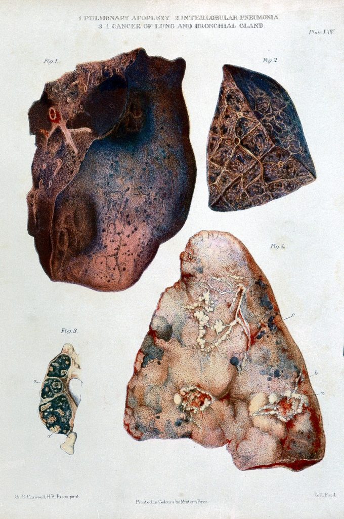 Examination of Medieval Healing Formulas Utilizing Dove Excrement, Fox Pulmonary Organs, and Additional Components Examination of Medieval Healing Formulas Utilizing Dove Excrement, Fox Pulmonary Organs, and Additional Components