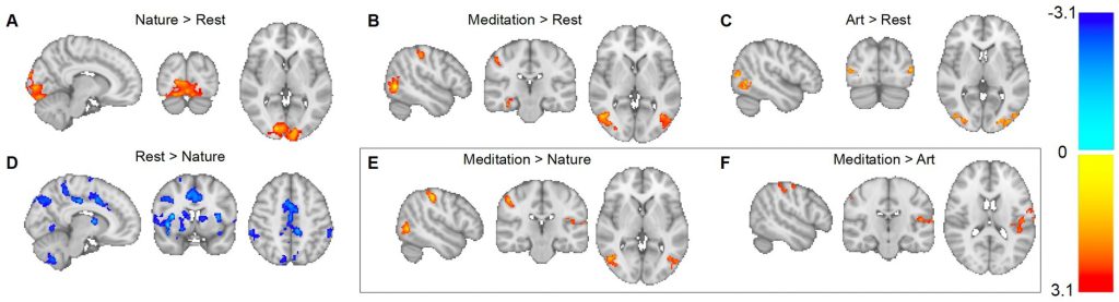 Study Finds that Viewing Art Benefits the Nervous System