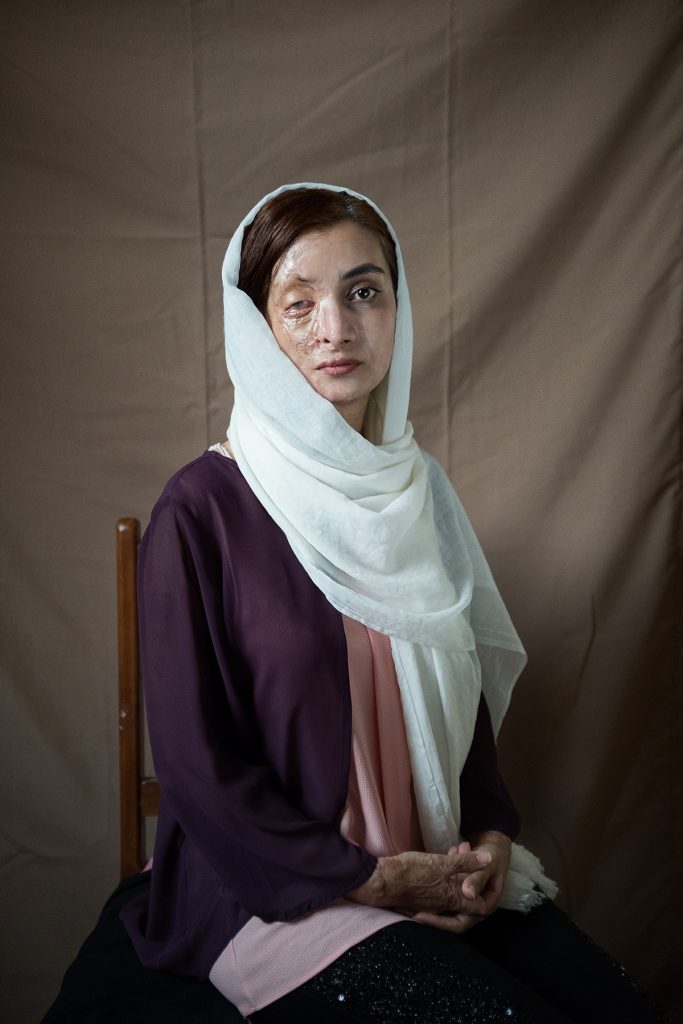 2025 Photo Awards Champion: Sima Choubdarzadeh