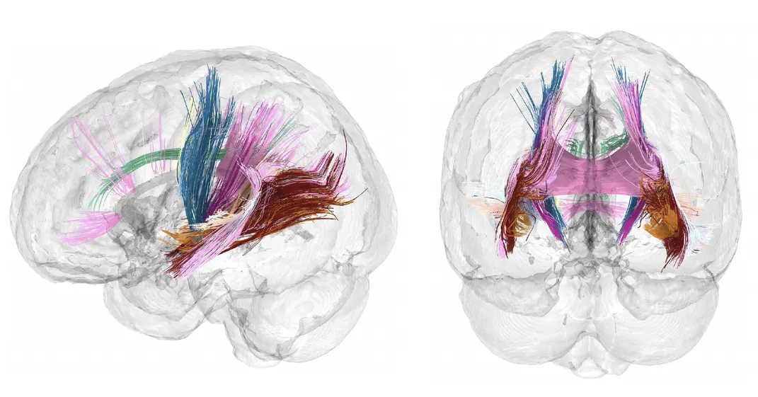 two brain diagrams illustrating brightly colored filaments inside the organ
