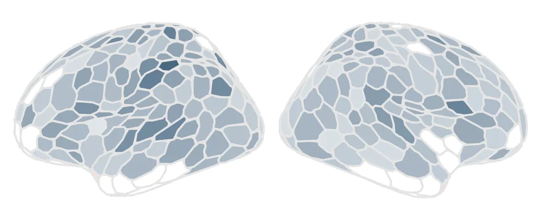 two grayscale brain diagrams represented in a heatmap, highlighting darker and lighter regions